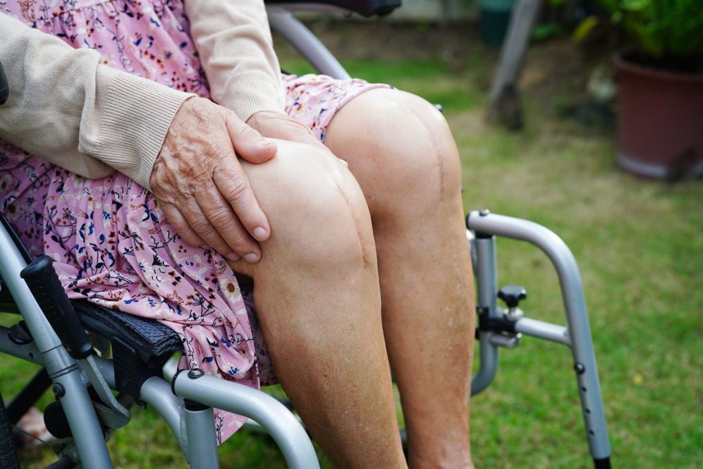 asian-elderly-woman-with-scar-knee-replacement-surgery